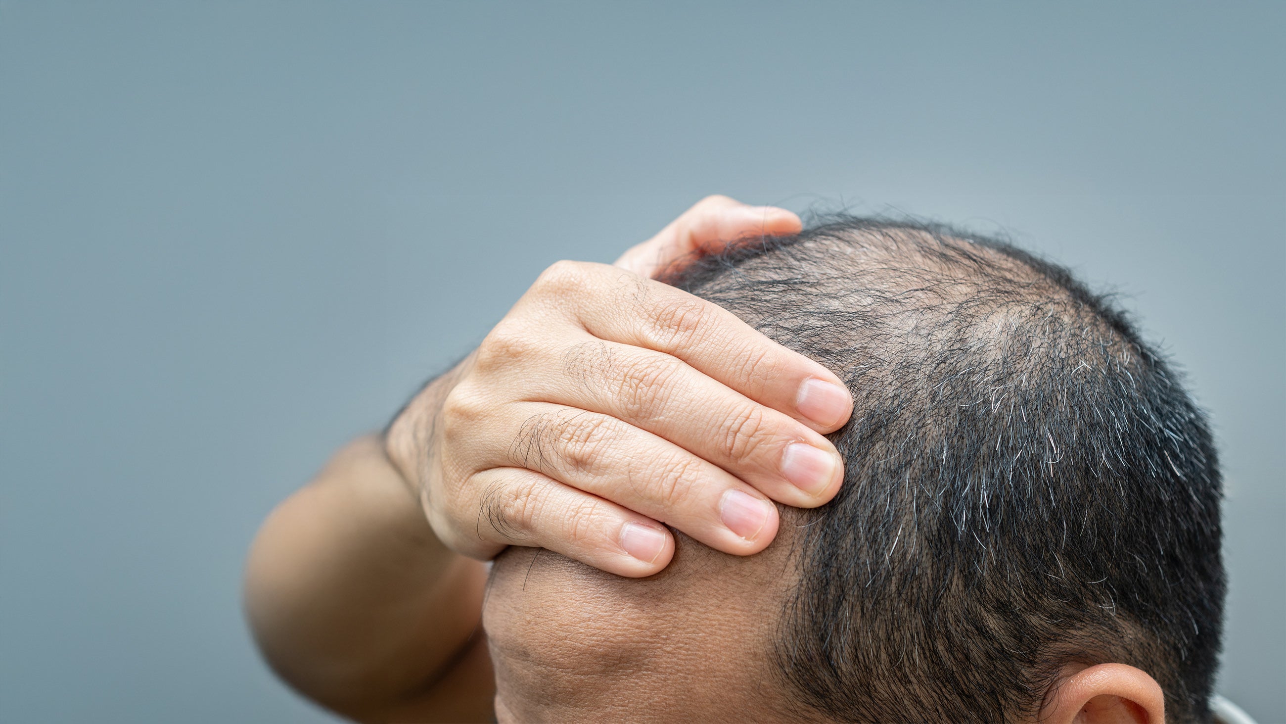 Person touching their head receives hair restoration treatments at Fix Studios Cincinnati Mason OH