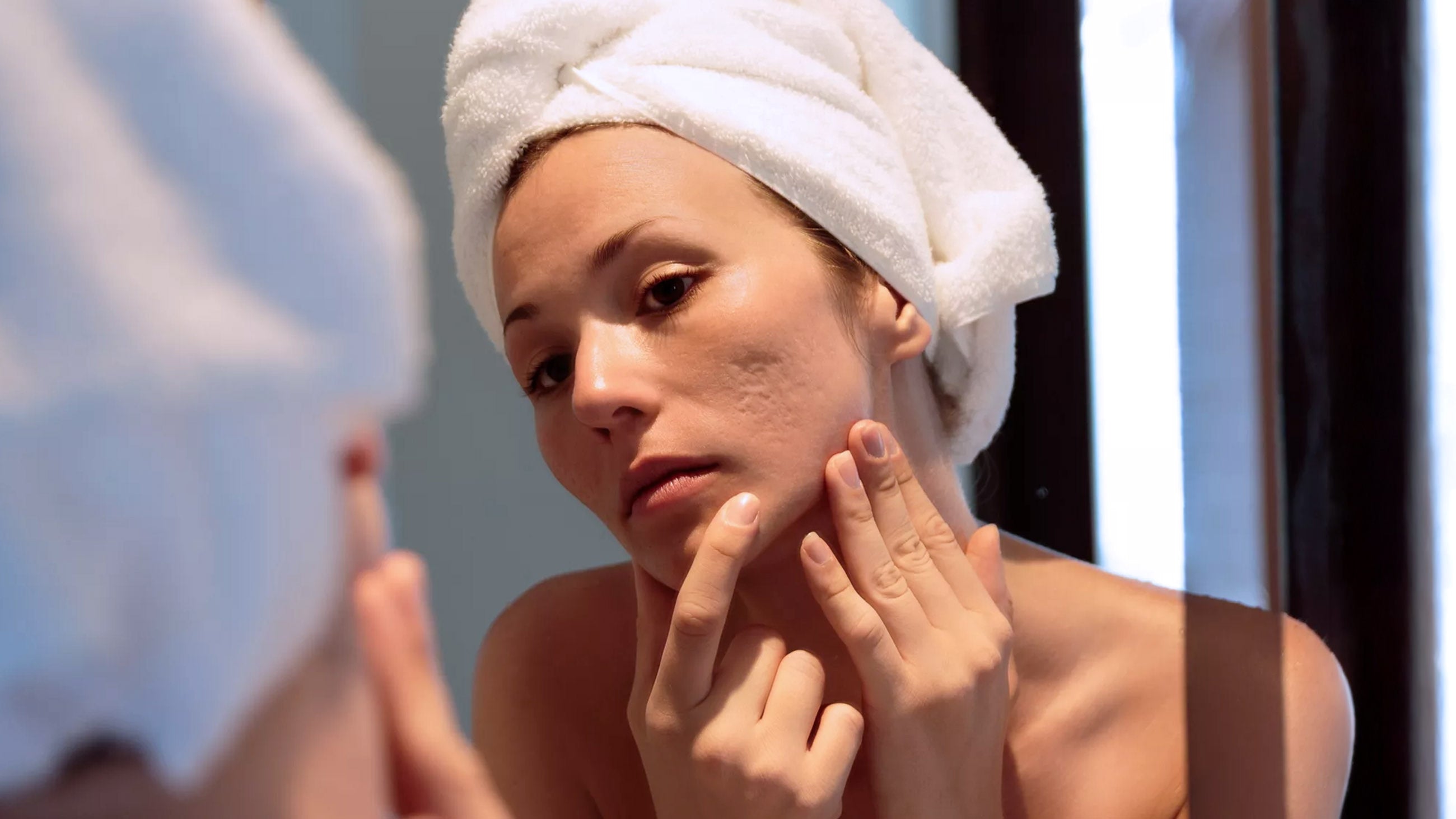 A woman looks in the mirror at her acne scars