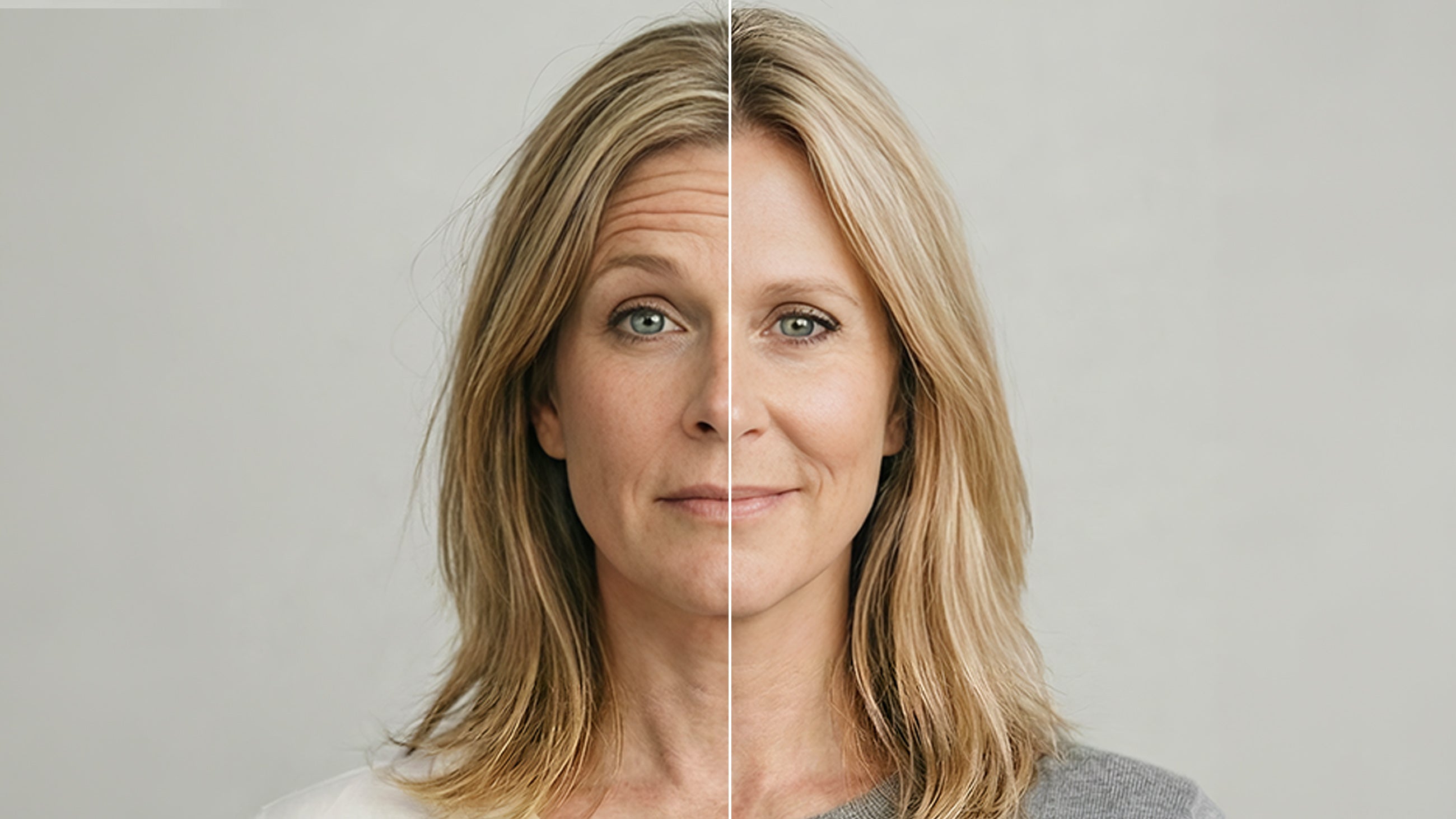 Best Botox in Cincinnati: 9 Things to Look for Before You Book