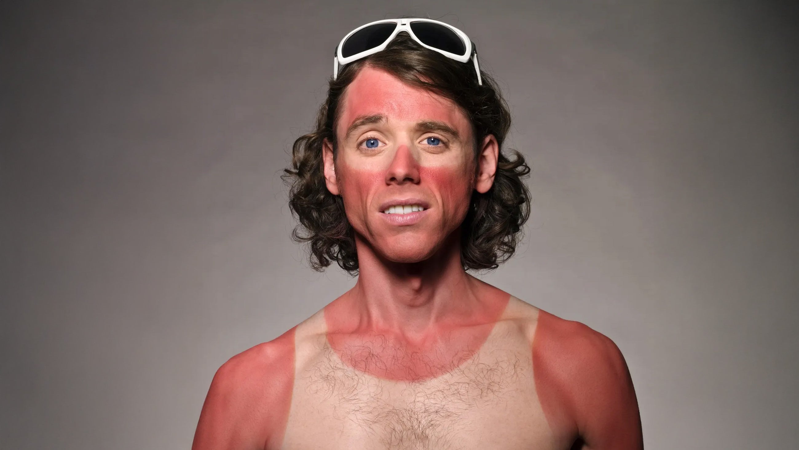 A sunburnt man is highlighted in the article 5 skin care mistakes to avoid in cincinnati's summer heat