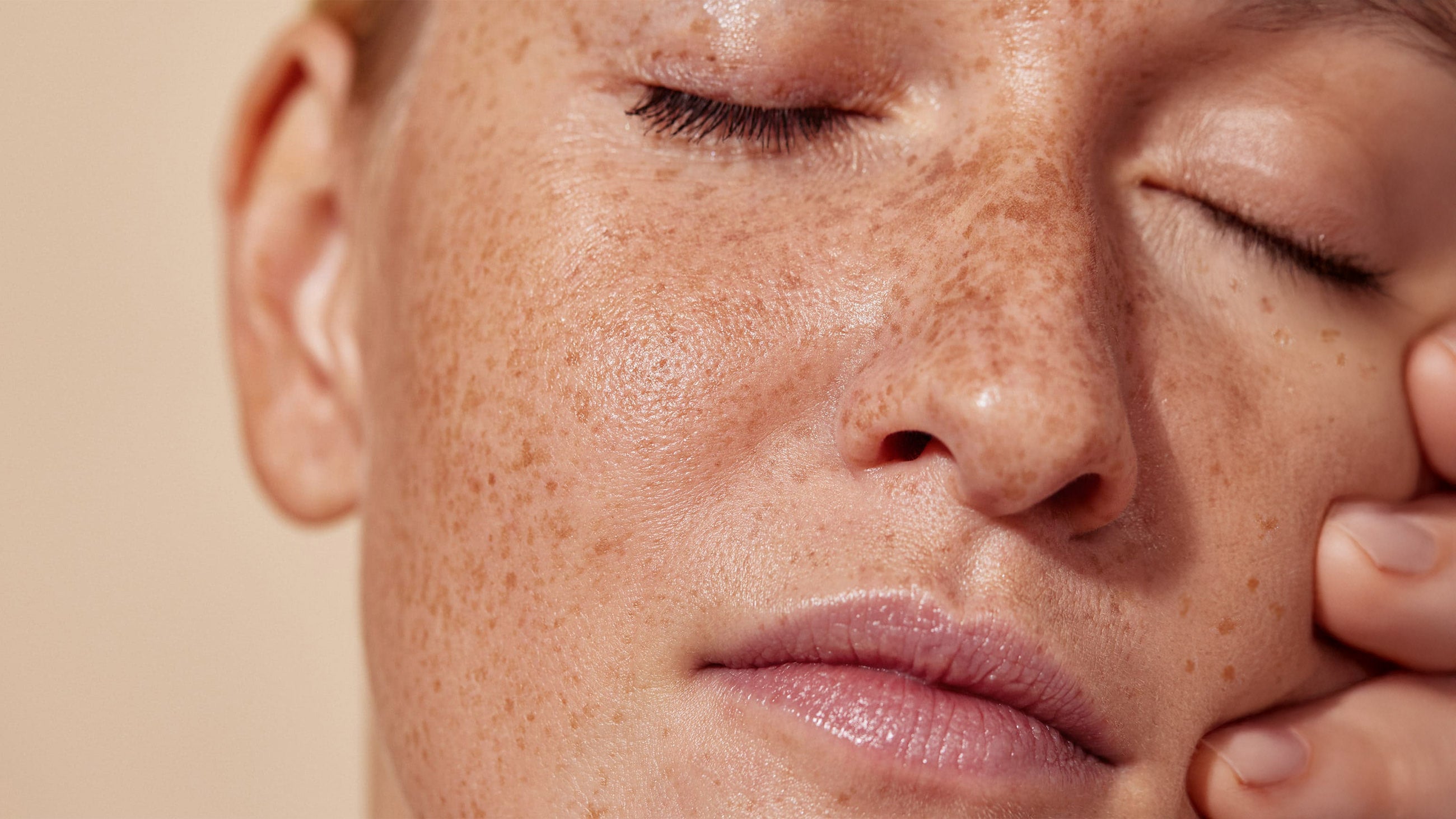 5 Simple Steps to Start Repairing Sun Damage at Home