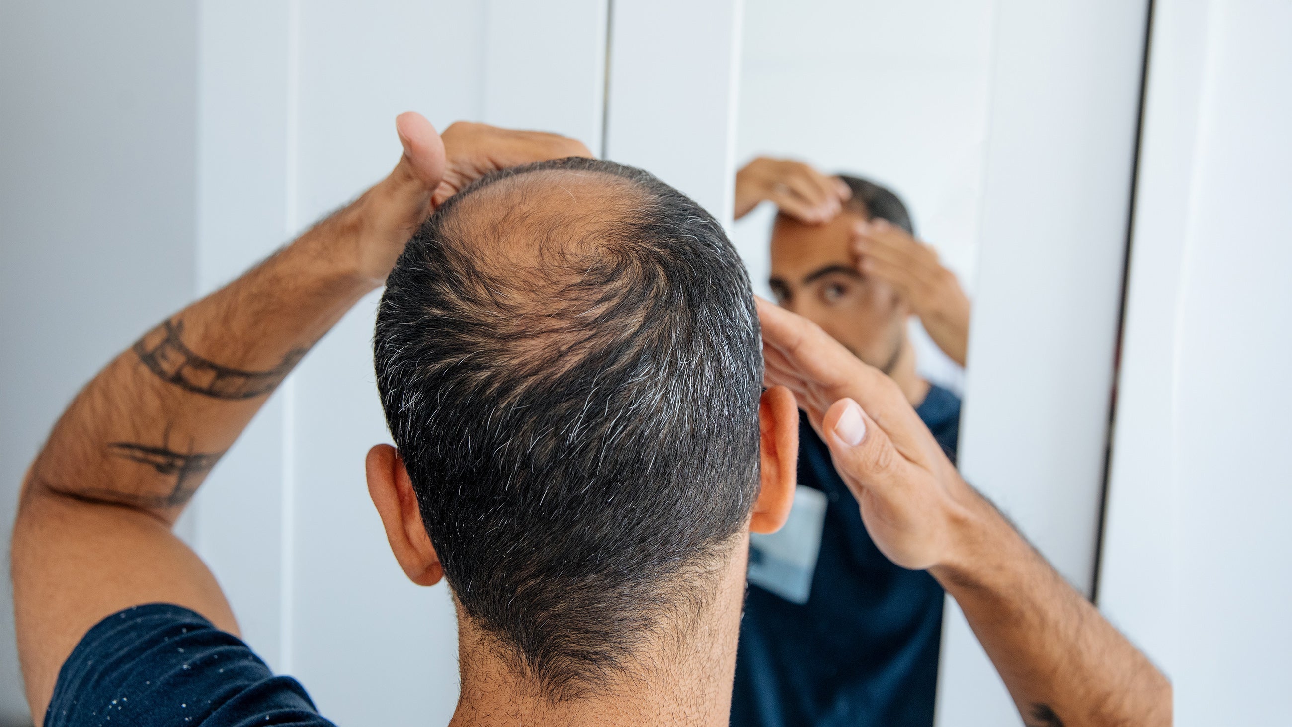 10 Foods to Eat to Reverse Hair Thinning Naturally