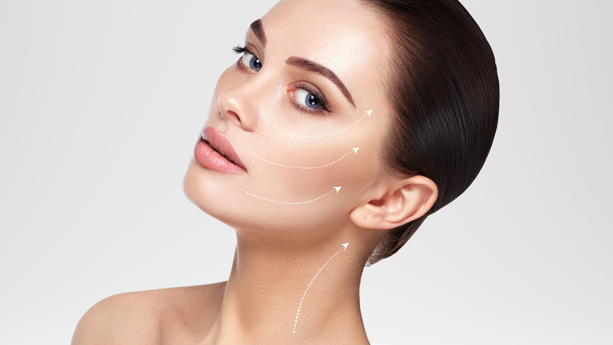 5 Reasons PDO Threads Are Safer and Better Than Fillers