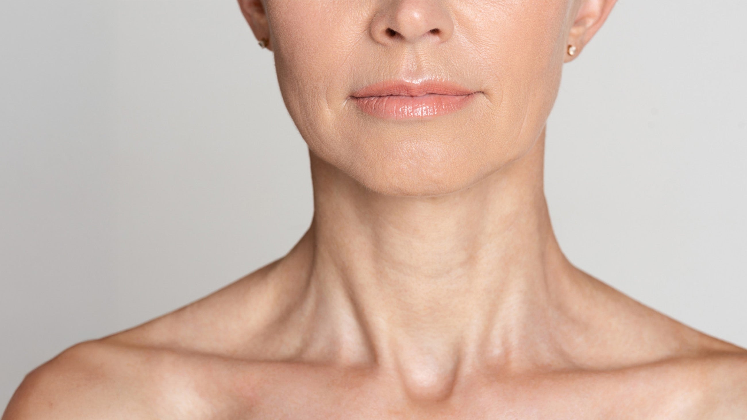 Jawline PDO Threads Before & After