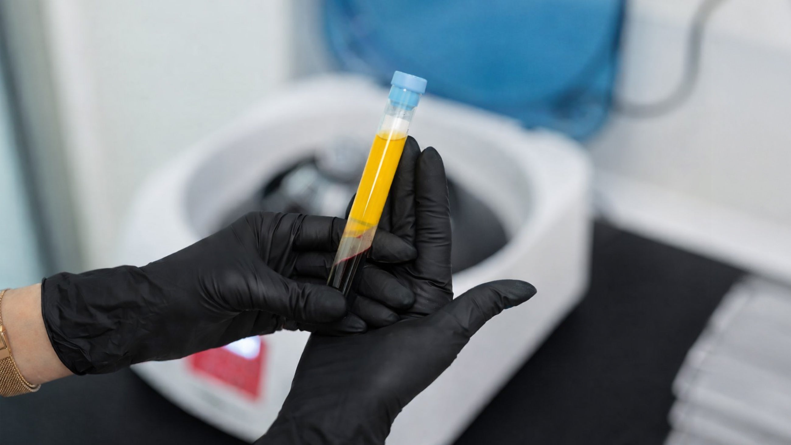 PRP/PRF injections Cincinnati Mason OH at Fix Studios