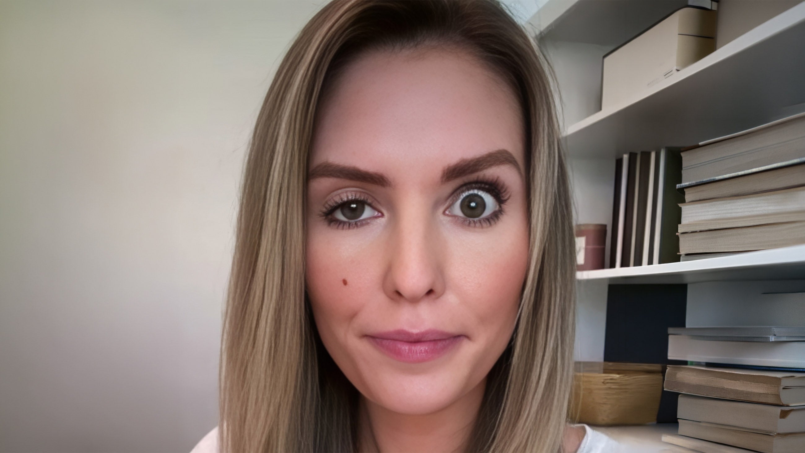 Bad Botox Cincinnati: 5 Signs Your Injector Cut Corners