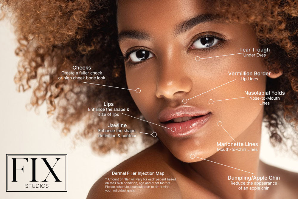 Dermal Filler treatments and services injection map fix studios medspa cincinnati mason OH