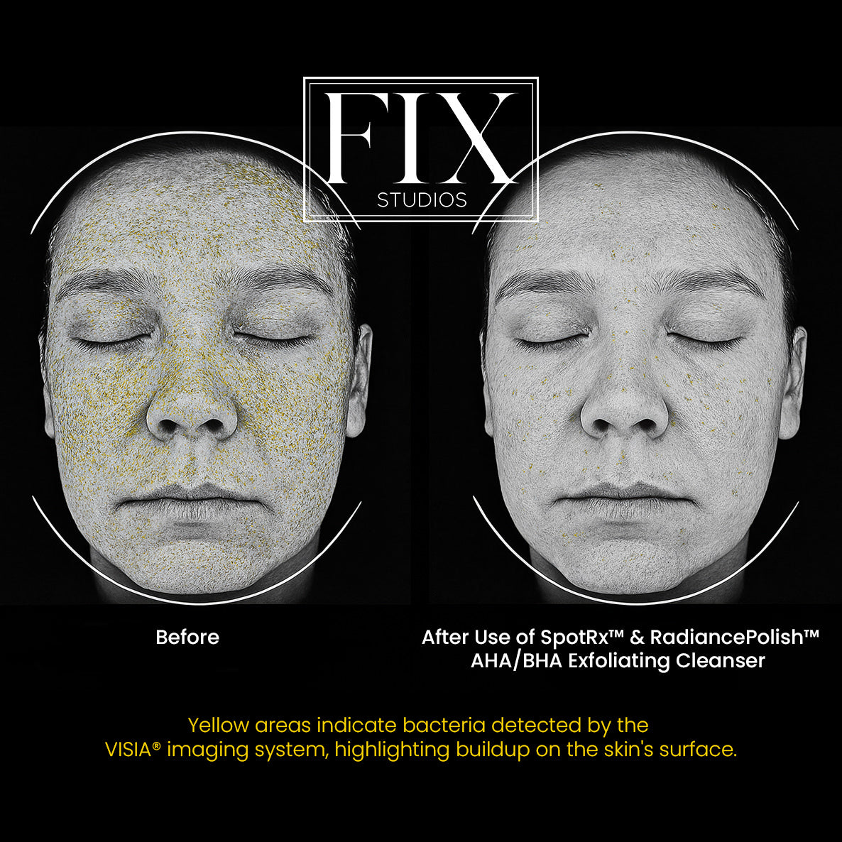Facial scan of using Fix Studios medical-grade skincare products