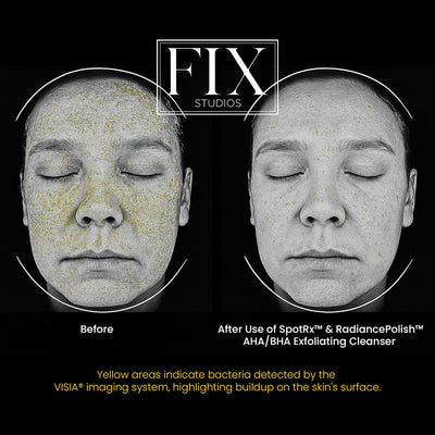 Facial scan of using Fix Studios medical-grade skincare products