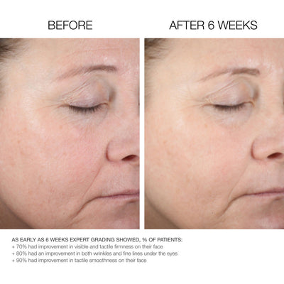 Fix Studios HydraSphere Complex Hyaluronic Acid Deep Hydration Serum Before and After Use