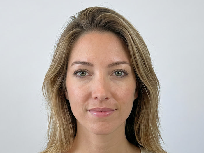 Botox Cincinnati Mason OH Before and After Fix Studios