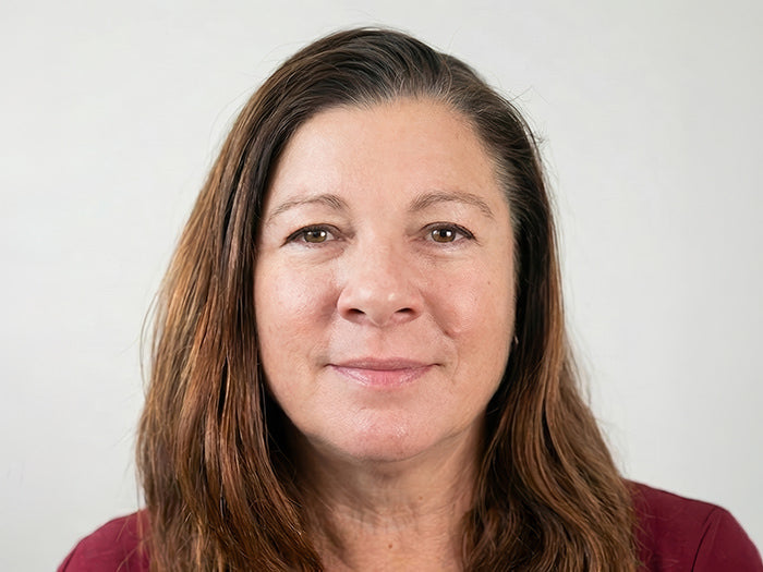 Botox Cincinnati Mason OH Before and After Fix Studios