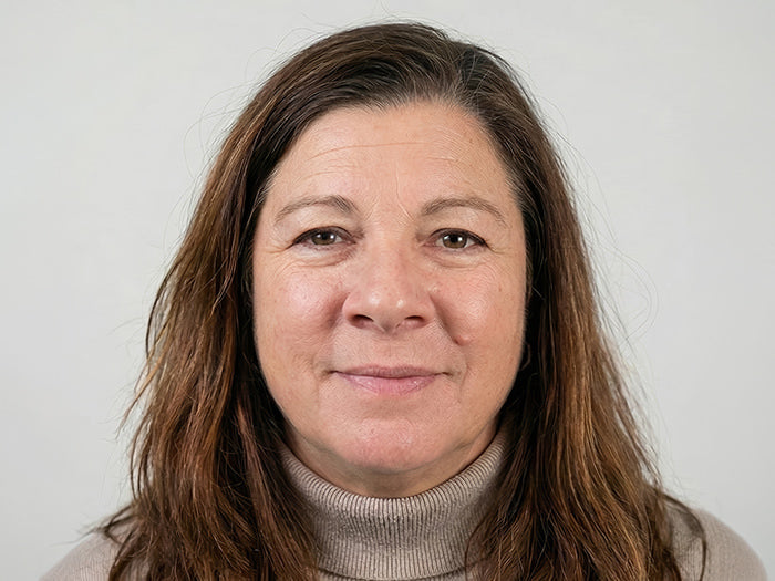 Botox Cincinnati Mason OH Before and After Fix Studios