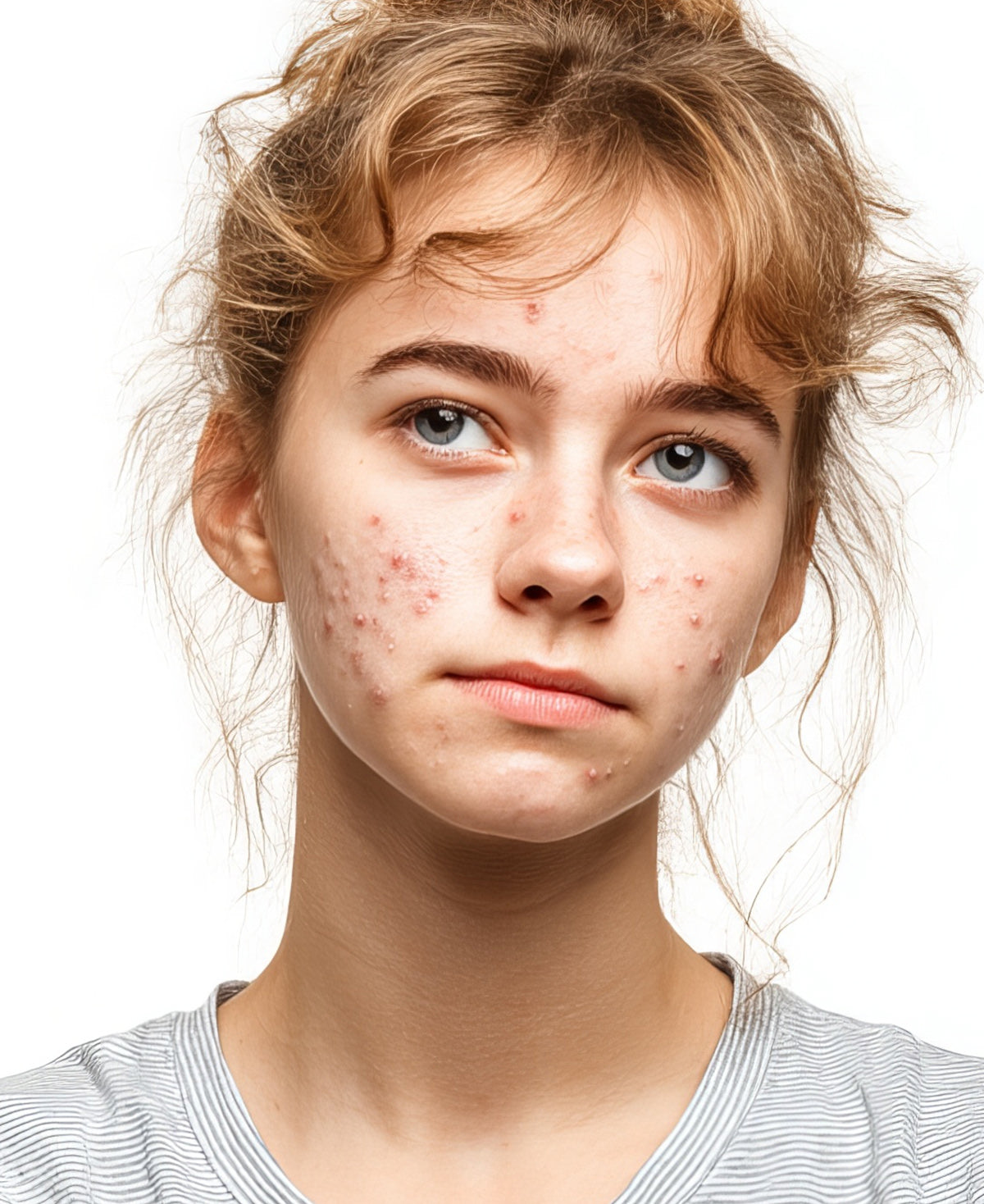 Fix Studios medical-grade ClarifyRx™ Pore Refining + Breakout Defense Serum defends agains breakouts
