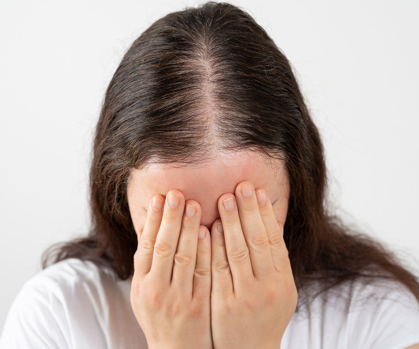 Hair Restoration Treatment services fix studios cincinnati mason OH