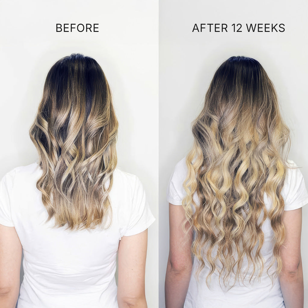 Hair Restoration Treatment services fix studios cincinnati mason OH