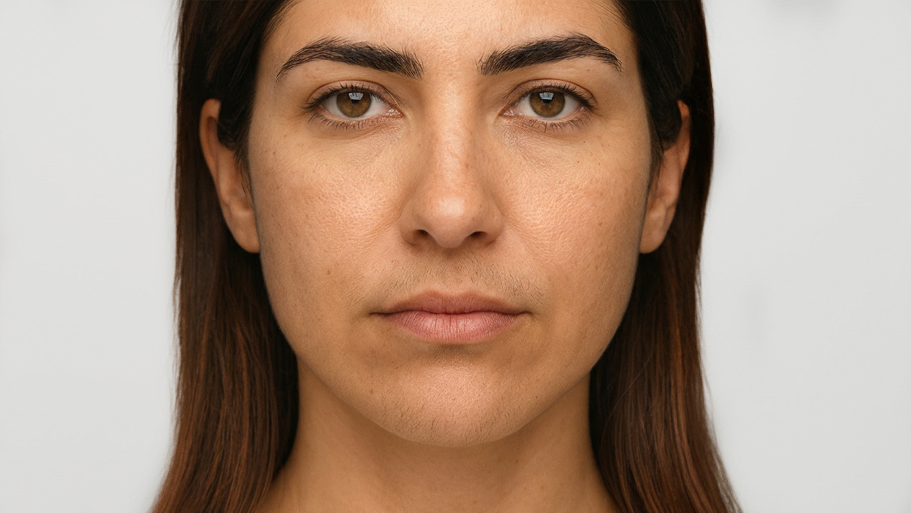 Diolaze Laser Hair Removal before and after at Fix Studios Cincinnati Mason OH