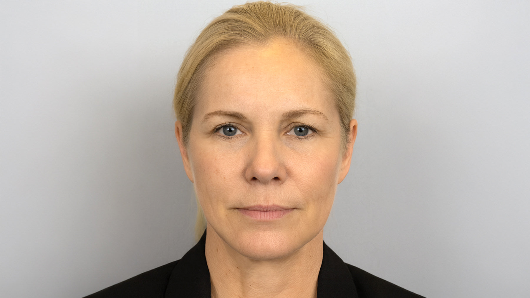 Morpheus8 RF microneedling skin tightening Cincinnati Mason before after at Fix Studios