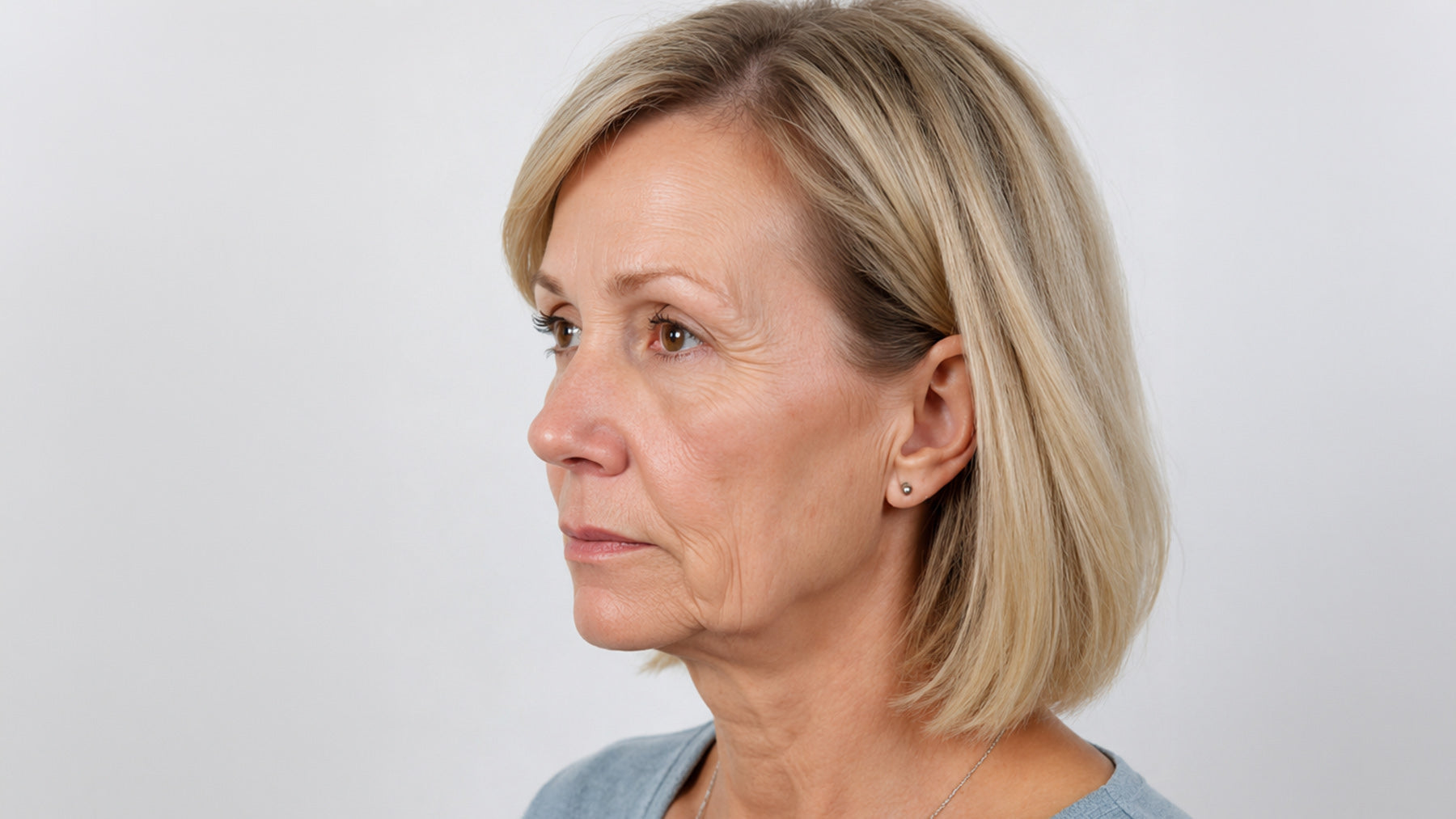 An image of a woman before her medspa treatments at Fix Studios Cincinnati Mason OH