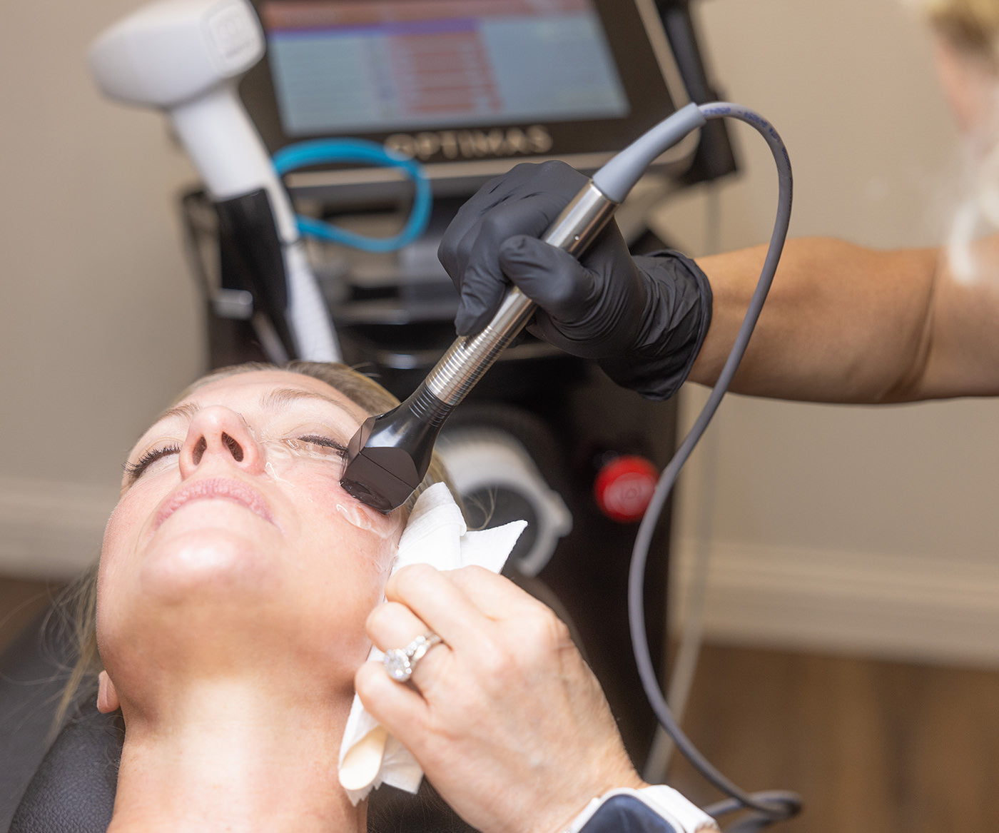 Forma RF Skin Tightening Treatment being performed on a patient at Fix Studios Cincinnati Mason OH