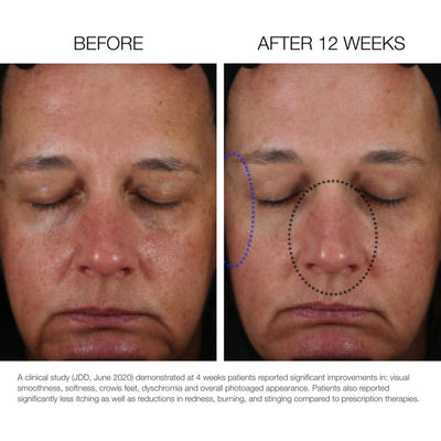 Fix Studios LustraCe CE + CTP Antioxidant Radiance Serum with 20% Vitamin C Before and After