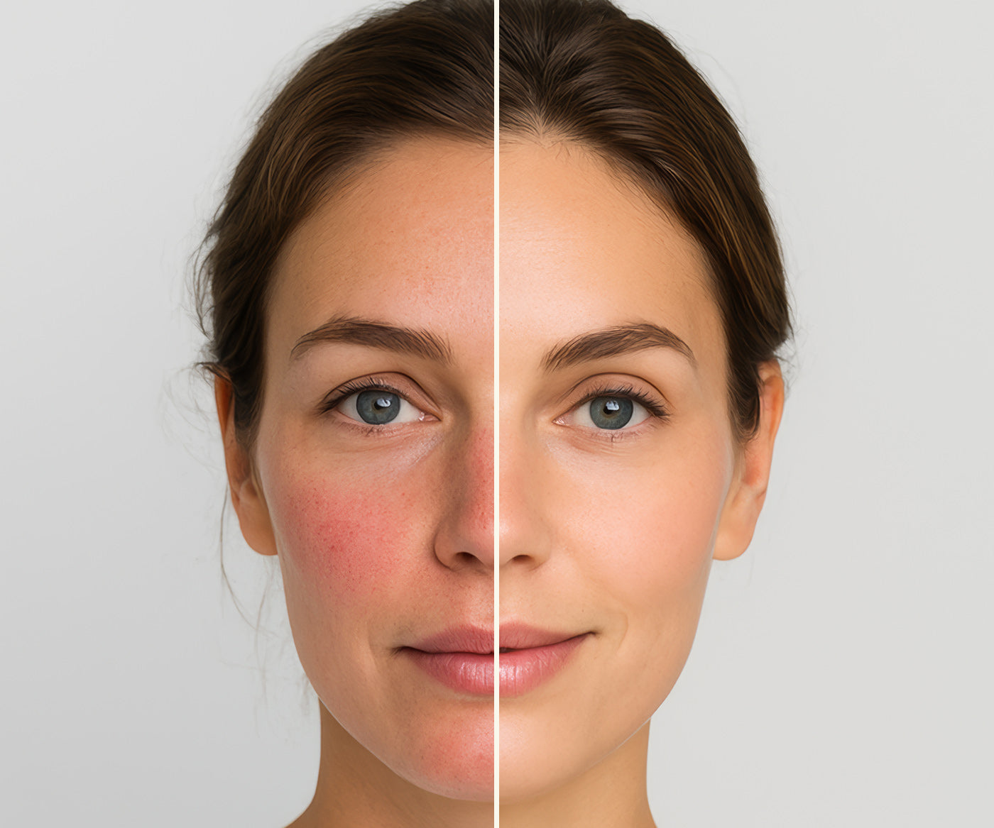 A clinical before an after photo of a woman with irritated red skin and used Fix Studios medical-grade PhytoRenewal™ Advanced Multi-Correction Serum. The after portion shows clam, healthy, smooth skin.