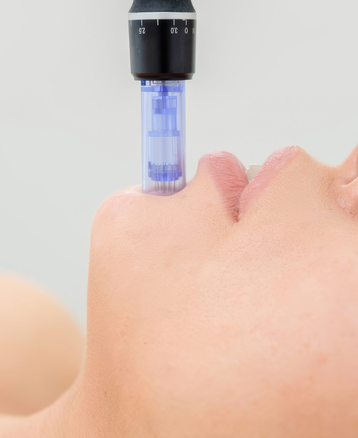 Fix Studios medical-grade Regenera™ Advanced Skin Repair Treatment is perfect for post treatment repair