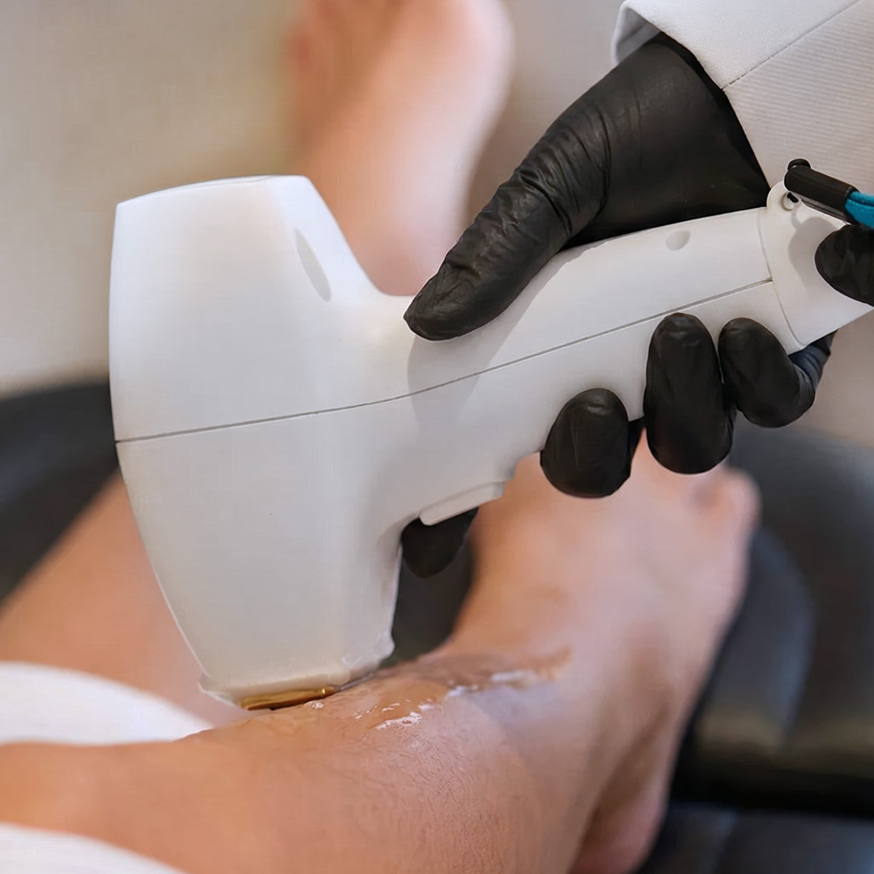 A woman receives a treatment of DiolazeXL Laser Hair Removal Cincinnati Mason OH at Fix Studios