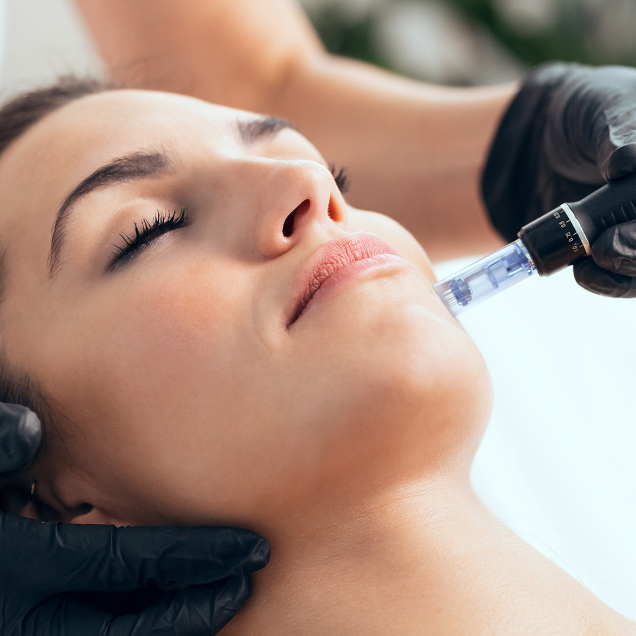A woman receives a microneedling facial treatment at Fix Studios medspa cincinnati mason oh